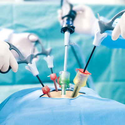 surgeries